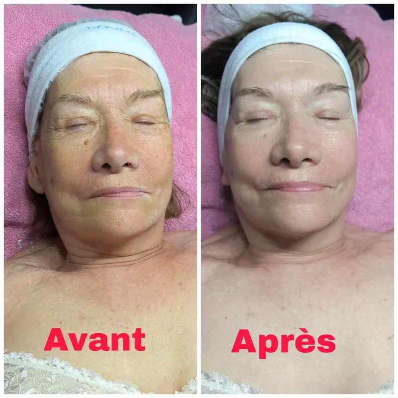 Réalisation Nana Zen 18